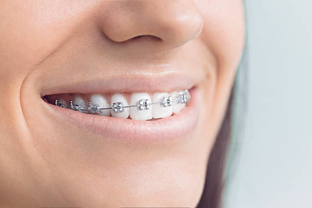 Best Invisalign and Clear Aligners  in Erie, PA